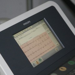 Telecardiologia, l'Ecg dall'ambulatorio all'ospedale in un click