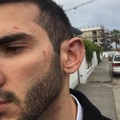 Aggredito perché omosessuale, calci e pugni in un hotel di Barletta