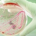 Escherichia coli O26 nelle acque reflue: «nessun allarme, era un fatto atteso»
