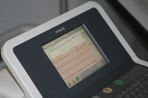 Telecardiologia, l'elettrocardiogramma in ambulatorio con l'Asl Bt