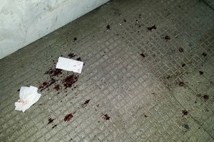 Macchie di sangue in via Imbriani