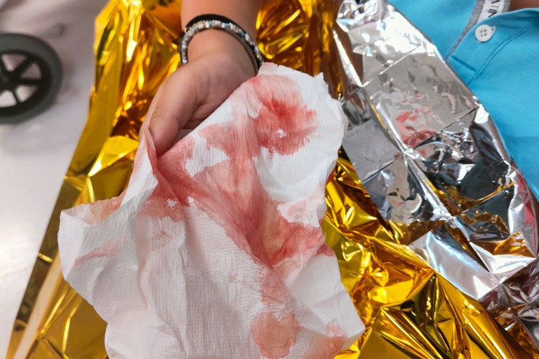 La ragazza ferita in ospedale